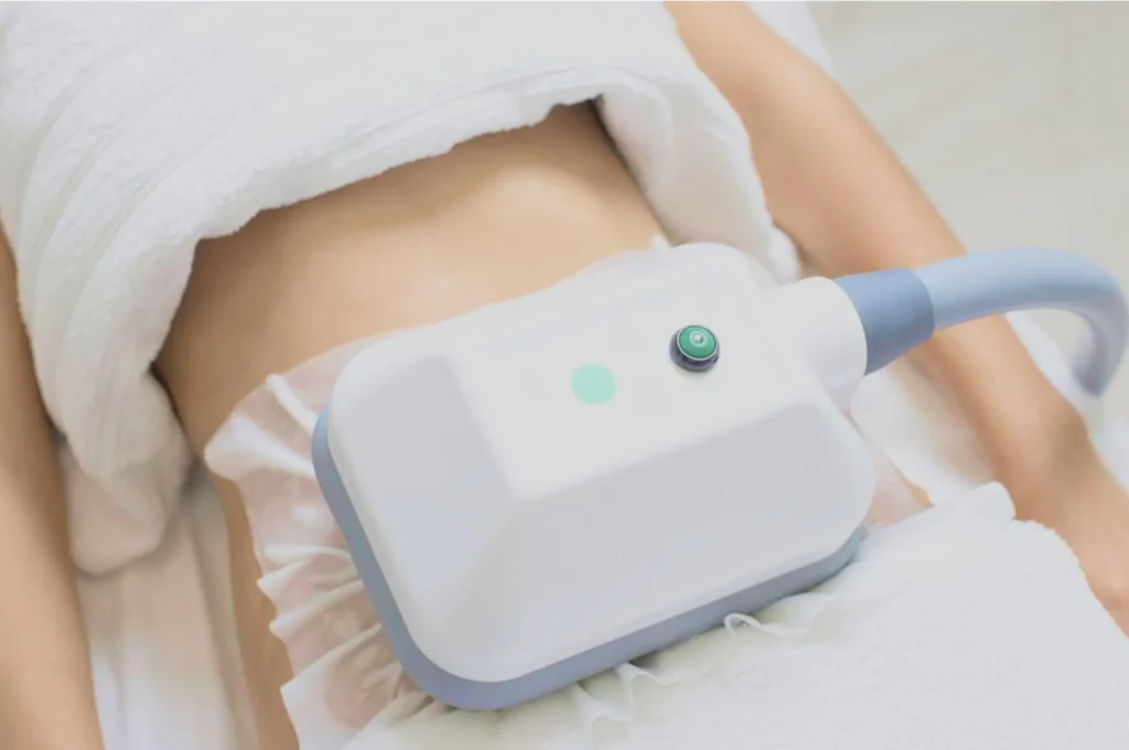 How Fat Freezing and HIFU Work Together? 3 advantages to combining Fat Freezing and HIFU St Albans