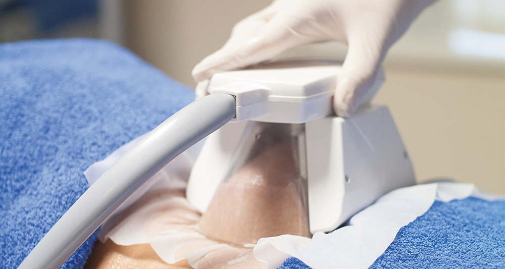 How Fat Freezing and HIFU Work Together? 2 Multiple Areas in One Session HIFU and Fat Freezing St Albans